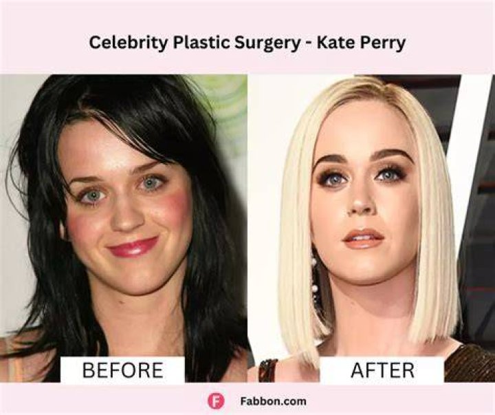 Has Martin Short Done Plastic Surgery? Before And After Photos