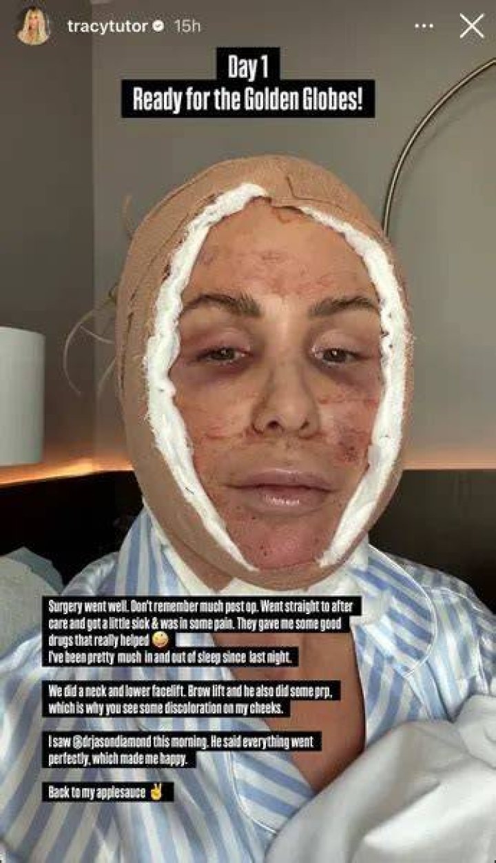 Tracy Tutor’s Plastic Surgery: Million Dollar Listing Star’s Cosmetic Alterations Explored!