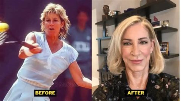 
What Illness Does Chris Evert Have? Fans Worried About Her Health 